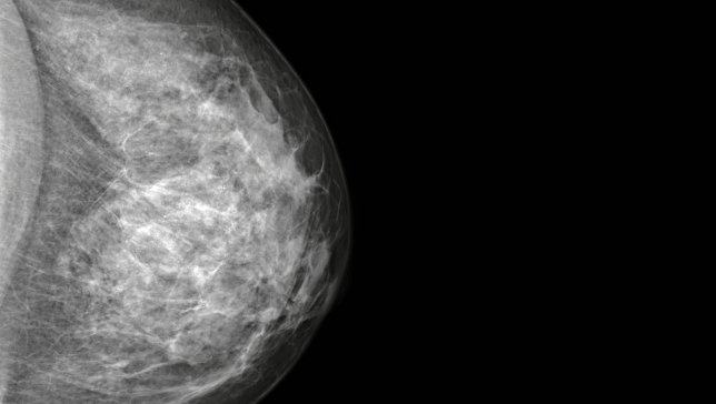 Mammographiegerät neuester Generation in der Paracelsus-Klinik Marl